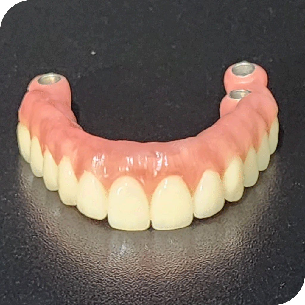 Implante Dentário Clínica Narimatsu