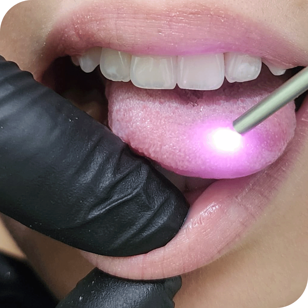 Laserterapia Clínica Narimatsu