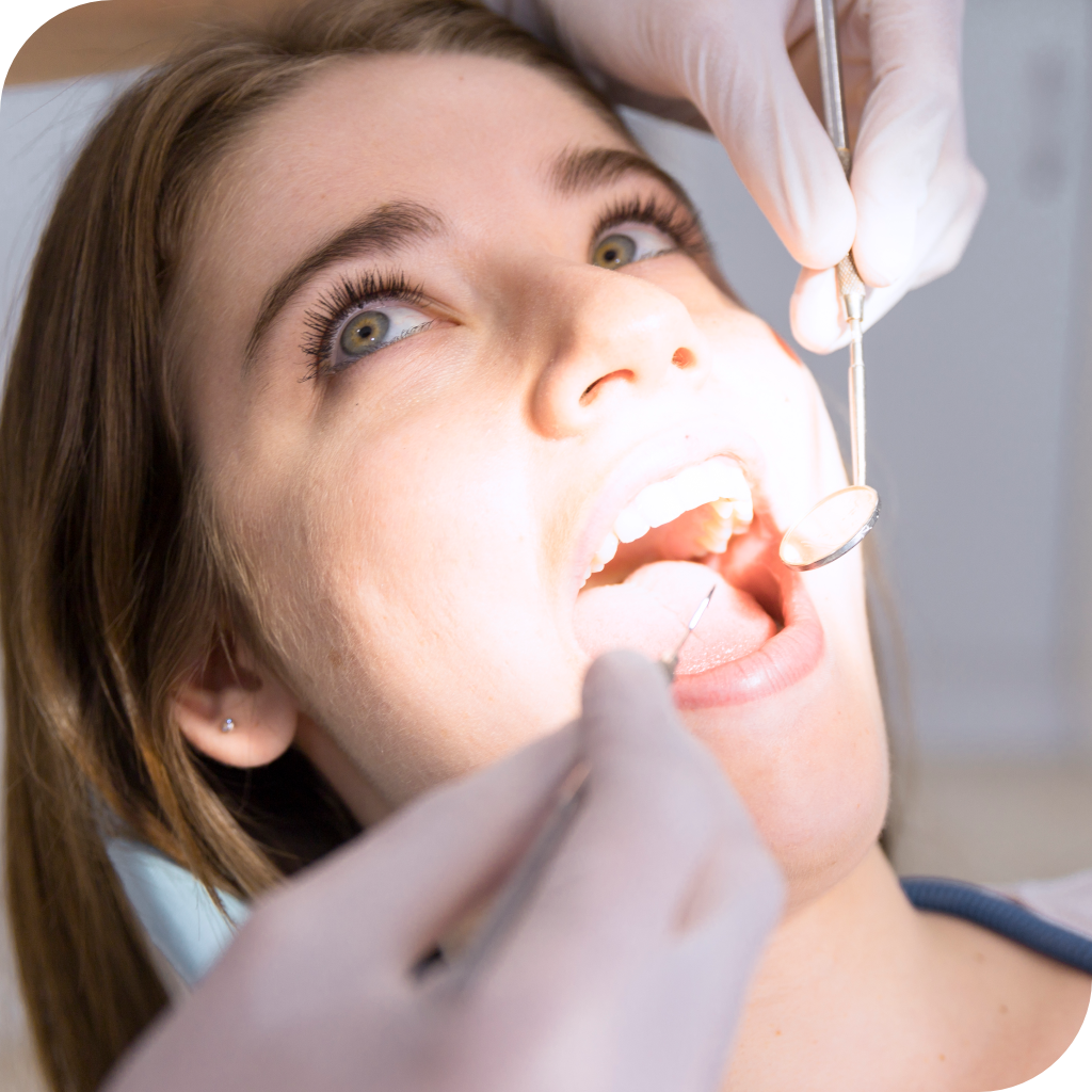 Limpeza e Raspagem Dental