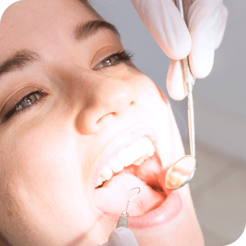Restaurações Dentárias Clínica Narimatsu